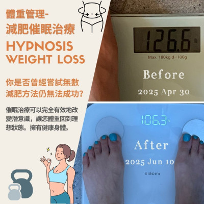 催眠治療